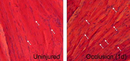 Ischemia causes skeletal muscle atrophy and tissue degradation. Ischemia causes skeletal muscle atrophy and tissue degradation.